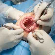 Anatomy